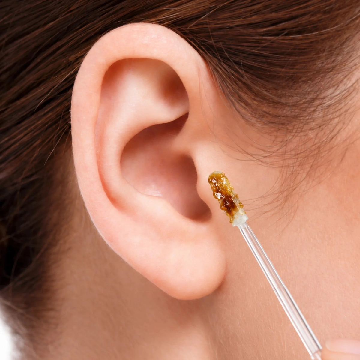 Close-up of an ear with a clear stick lifting a small amount of amber earwax from the outer ear